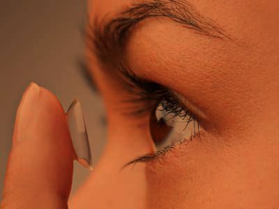 Kontaktlencsék Kontaktlencsék